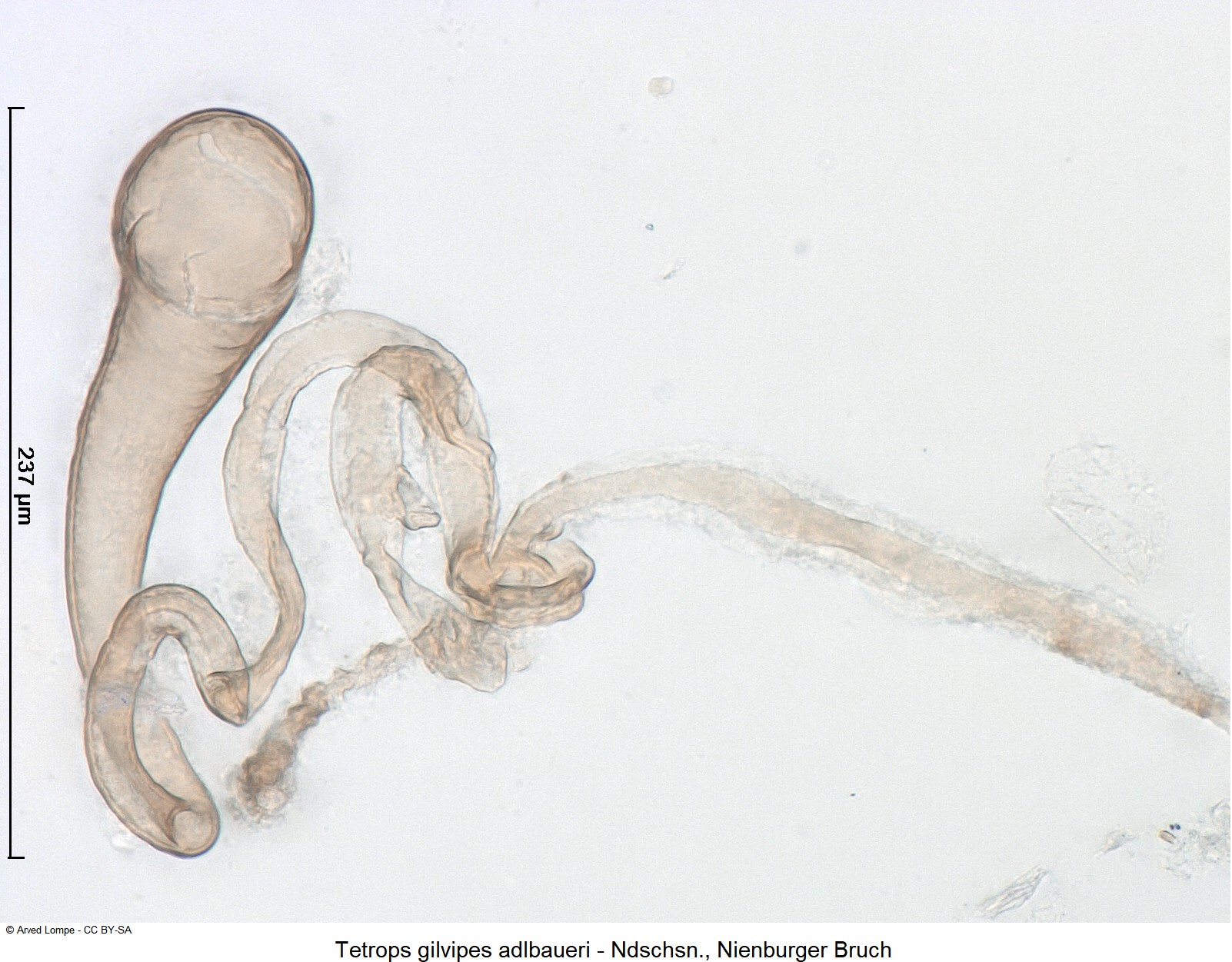 tetrops_adlbaueri_ck35742072_sperm.jpg
