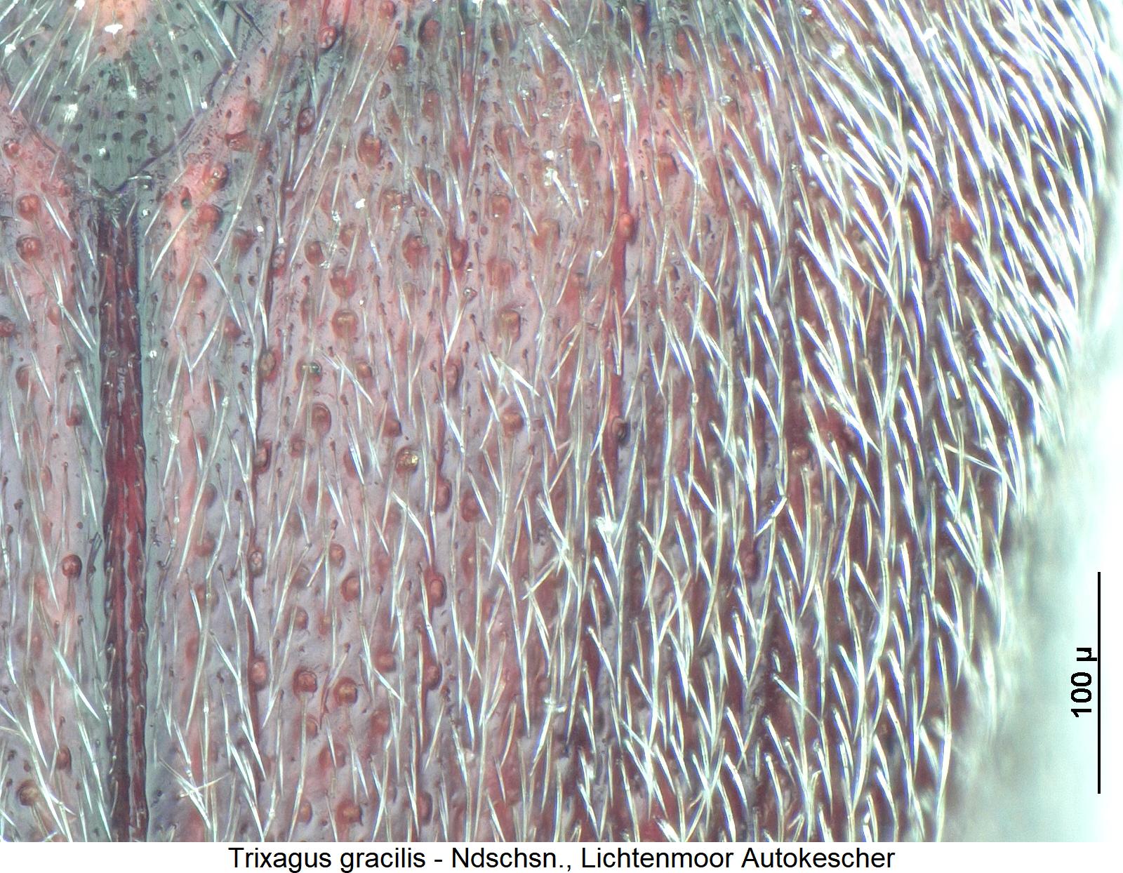 trixagus_gracilis_ms.jpg