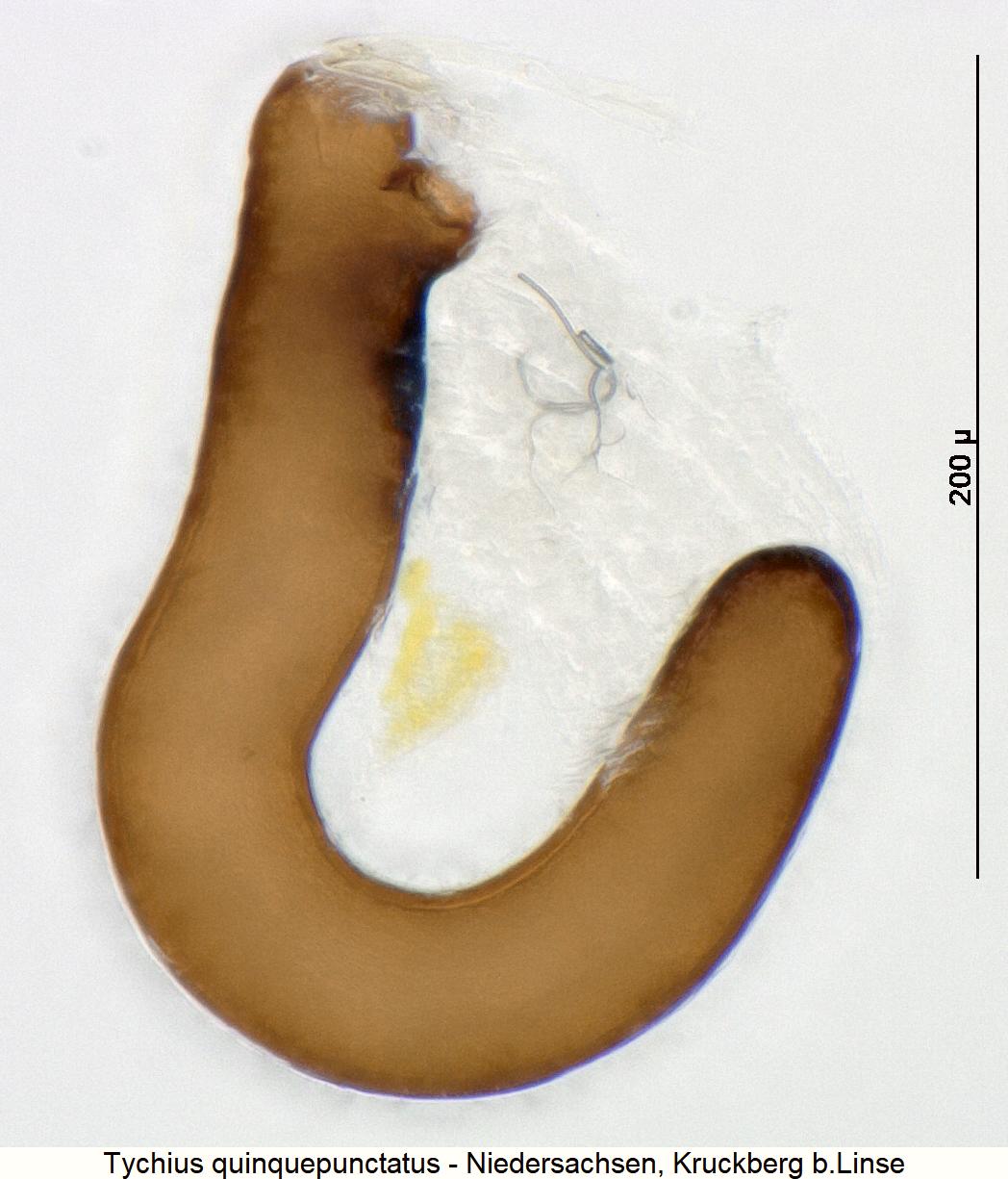 tychius_quinquepunctatus_sperm.jpg